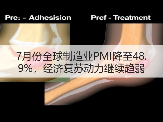 7月份全球制造业PMI降至48. 9%，经济复苏动力继续趋弱(图2)