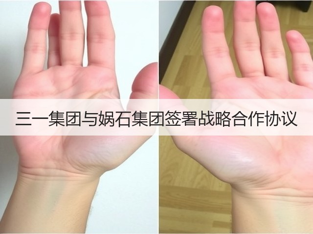 三一集团与娲石集团签署战略合作协议(图3)
