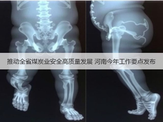 推动全省煤炭业安全高质量发展 河南今年工作要点发布(图1) 推动全省煤炭业安全高质量发展 河南今年工作要点发布(图1)