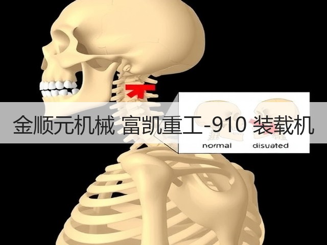 金顺元机械 富凯重工-910 装载机(图3) 金顺元机械 富凯重工-910 装载机(图3)