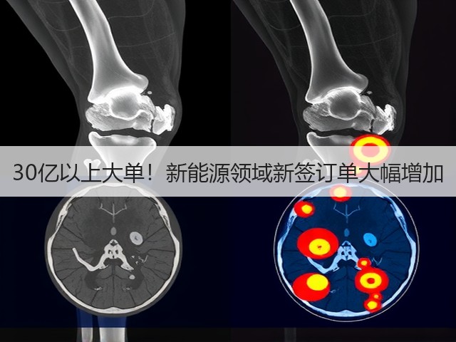 30亿以上大单！新能源领域新签订单大幅增加(图2)