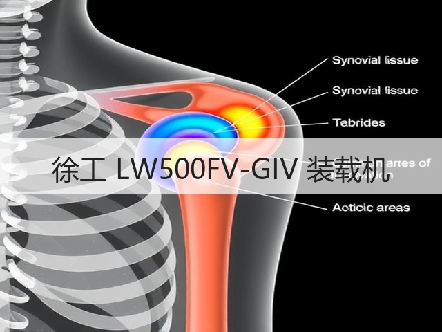 徐工 LW500FV-GIV 装载机(图1) 徐工 LW500FV-GIV 装载机(图1)